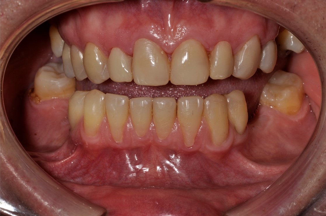 Cosmetic Bonding Halifax, NS Dr. Jenine Arab Omalley